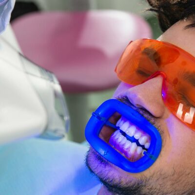 Top 5 Different Teeth Whitening Procedures